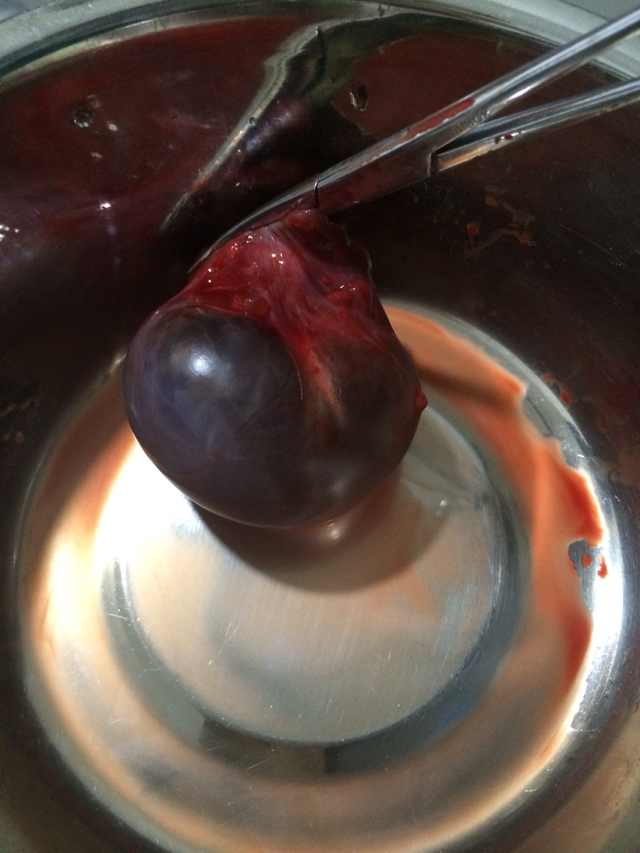 ר������ȡ"ը��"ʮ�겡ʹһ����